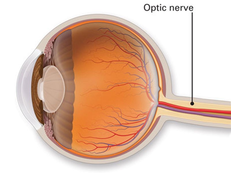 Optic Nerve Issue Symptoms At Jason Olinger Blog