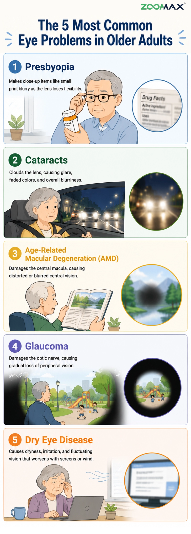 infographic of 5 most common eye diseases in older adults including presbyopia, cataracts, amd, glaucoma and dry eye disease.
