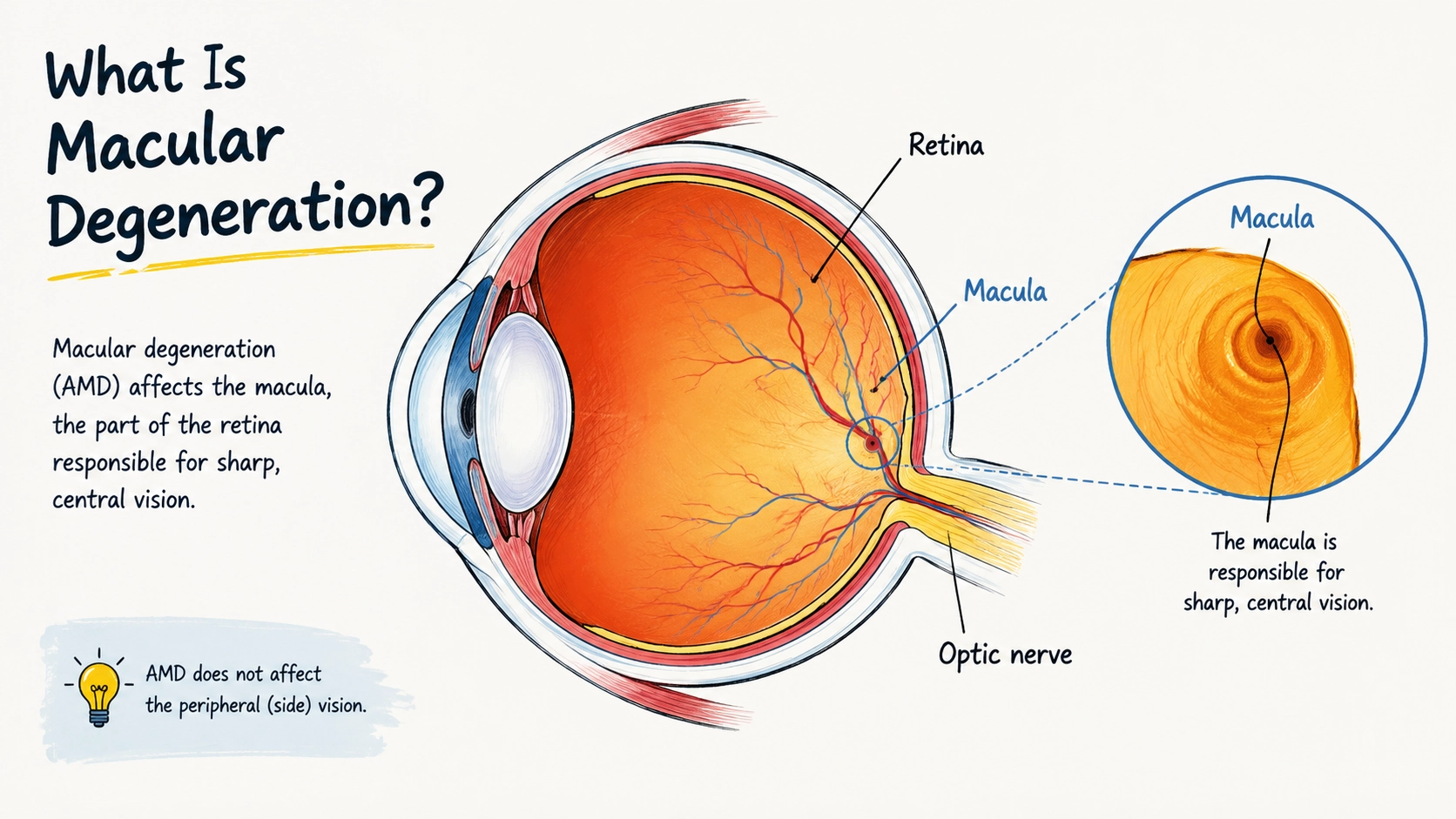 what is macular degeneration educational cross‑section diagram of human eye labelling retina, macula and optic nerve