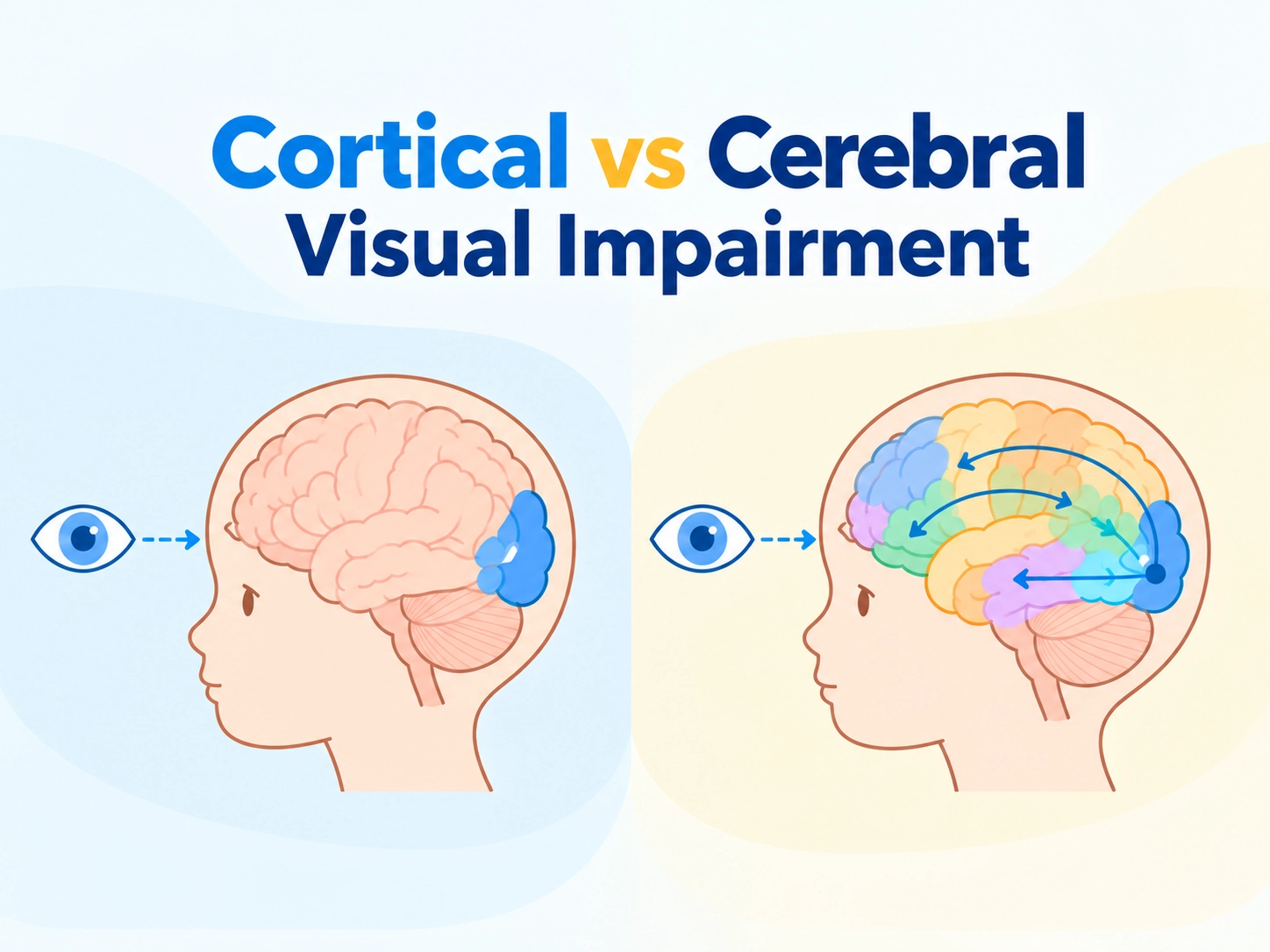 cortical vs. cerebral visual impairment